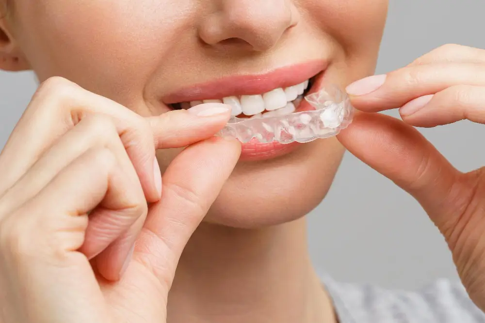 Invisalign em Betim
